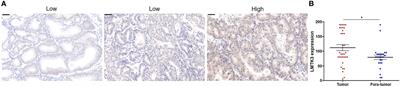 Knockdown of LMTK3 in the Endometrioid Adenocarcinoma Cell Line Ishikawa: Inhibition of Growth and Estrogen Receptor α